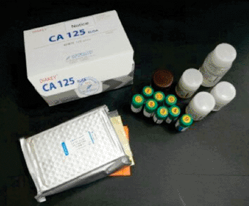 Imagen: El kit ELISA para el antígeno de cáncer 125 (CA-125), diseñado para predecir el riesgo de cáncer de ovario (Fotografía cortesía del Grupo Alibabá).